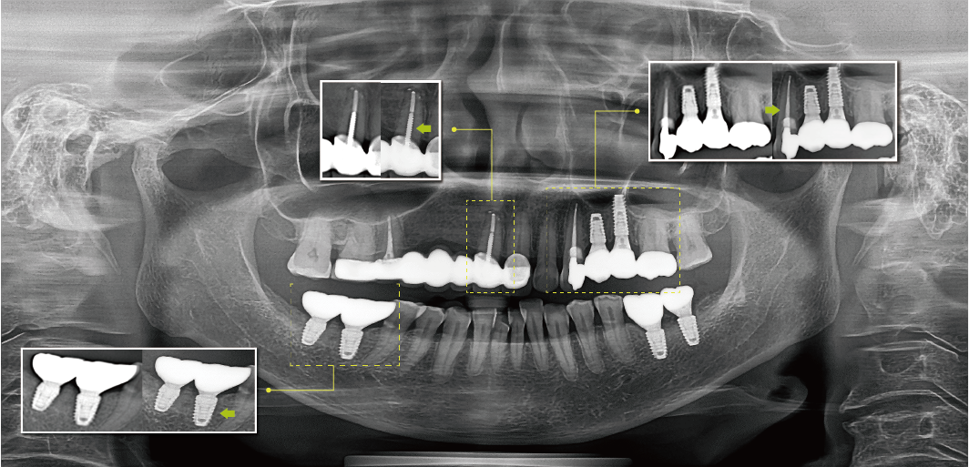 1746501561571926.png 未標題-3_畫板 1.png