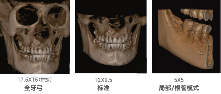 1761027089499529.jpg brightCT-01.jpg